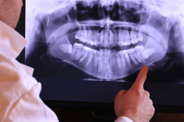 Best Teeth Whitening  in White Sands, NM
